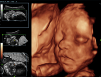 3d fetal face