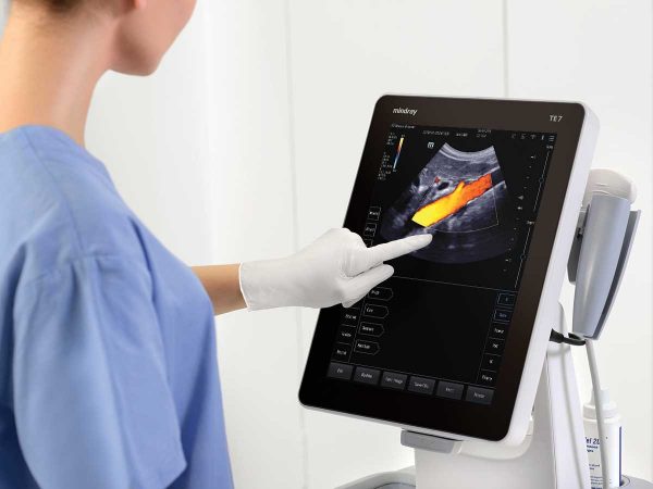 5 TE7 tech touching screen