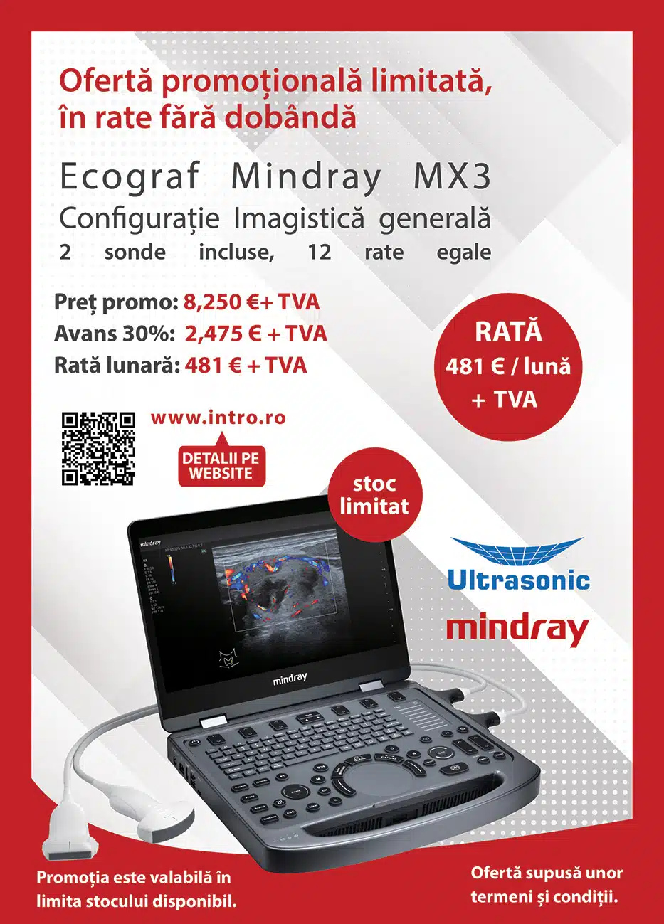 mx3