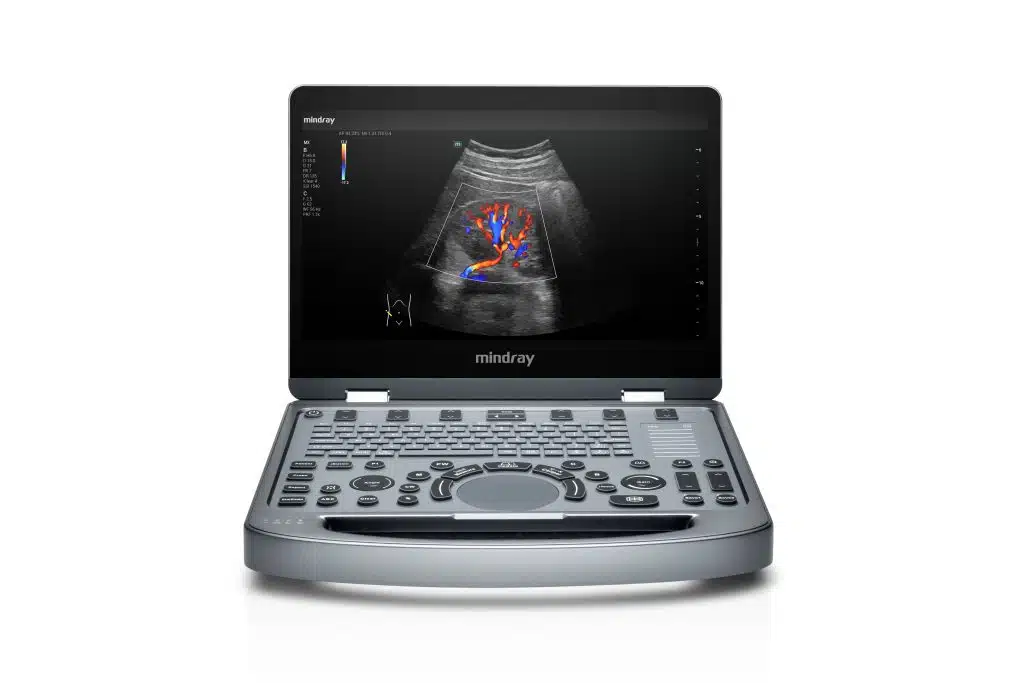 未命名会话54393 with clinical image 未命名会话54393 with clinical image
